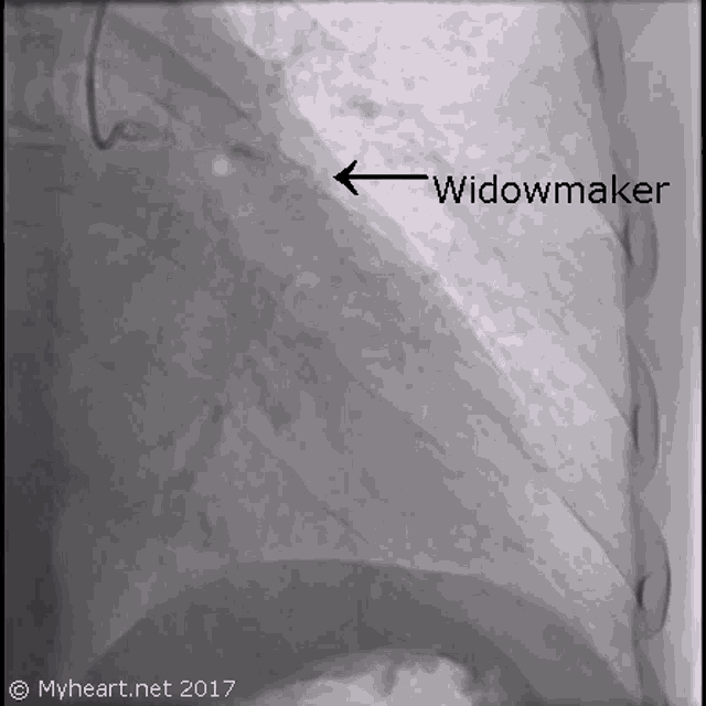 Widow Maker GIF - Widow Maker Heart - Discover & Share GIFs